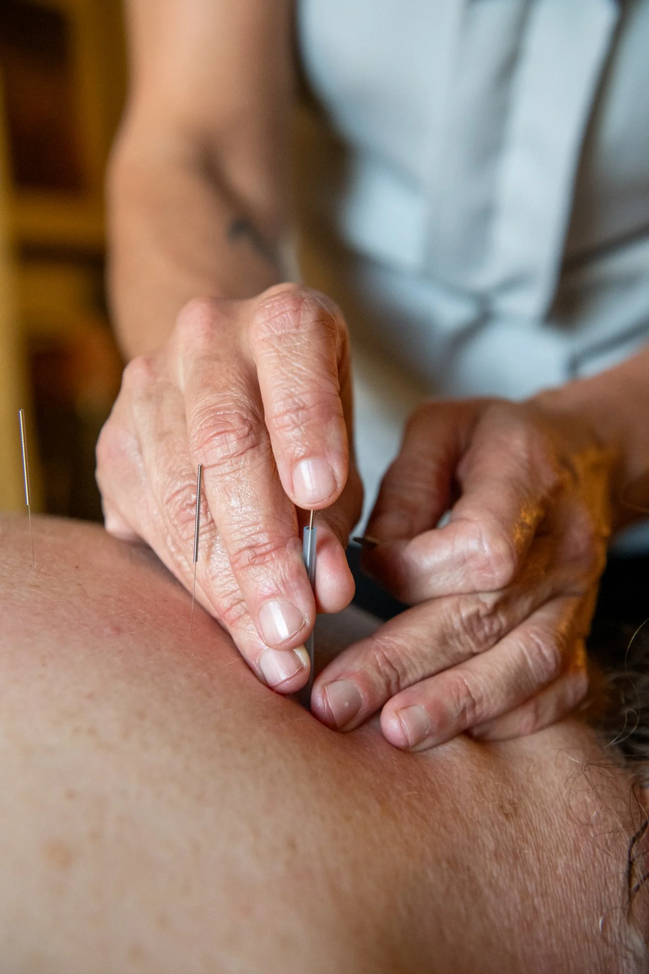 julie-acupuncture-6.jpg