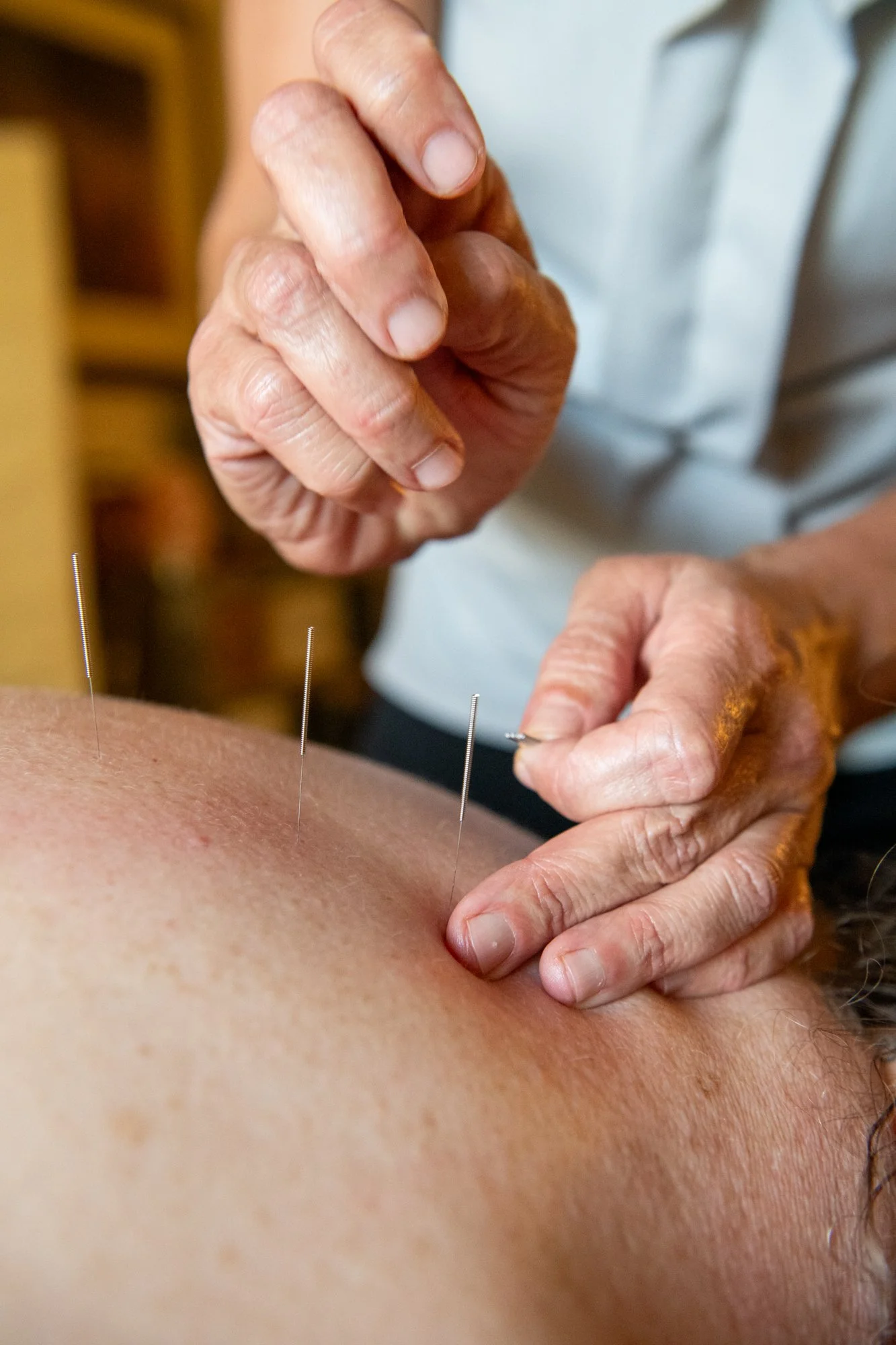 julie-acupuncture-7.jpg