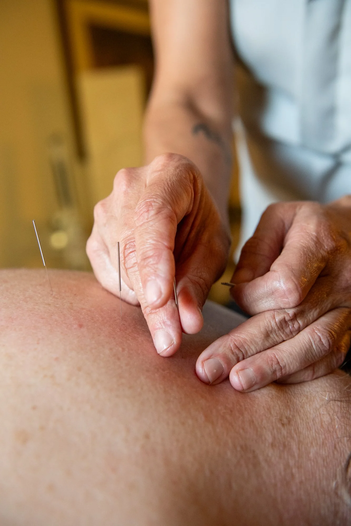 julie-acupuncture-8.jpg