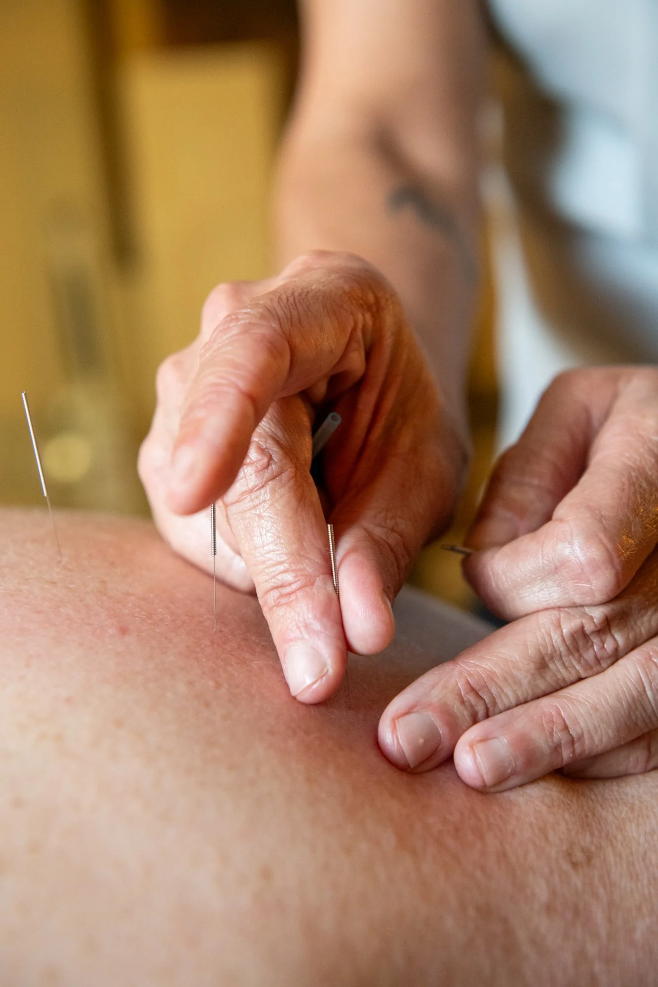 julie-acupuncture-9.jpg