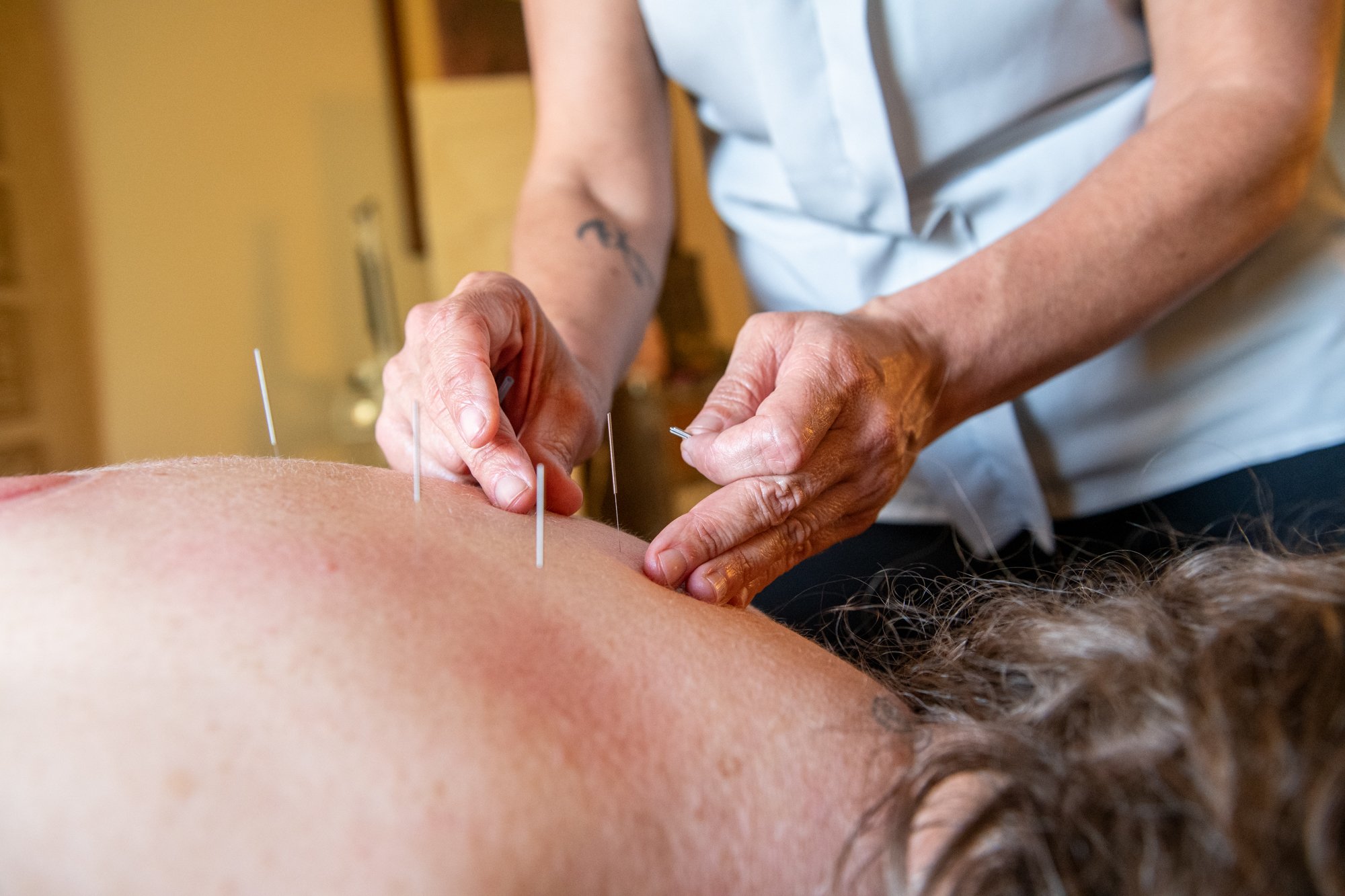 julie-acupuncture-11.jpg