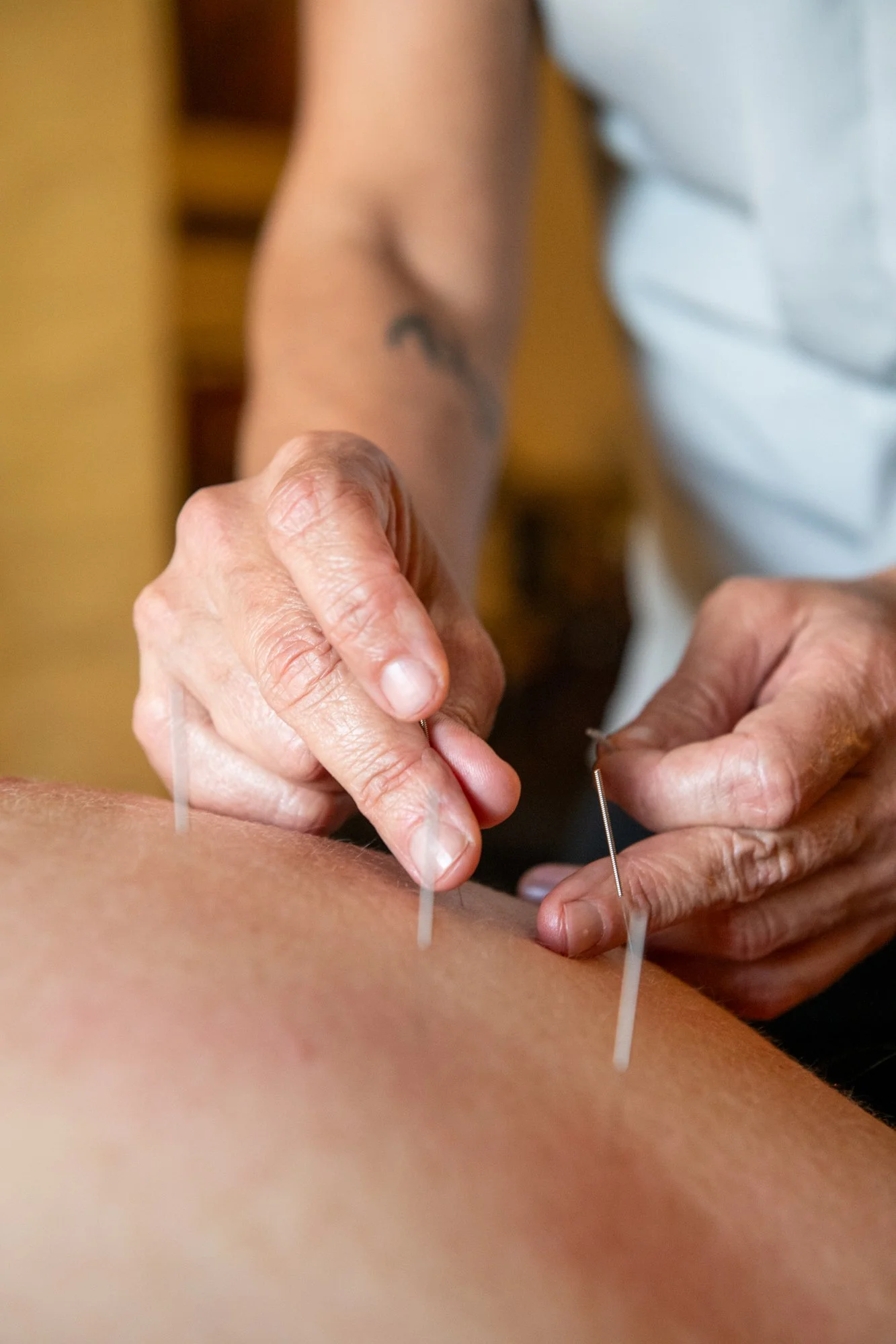 julie-acupuncture-12.jpg