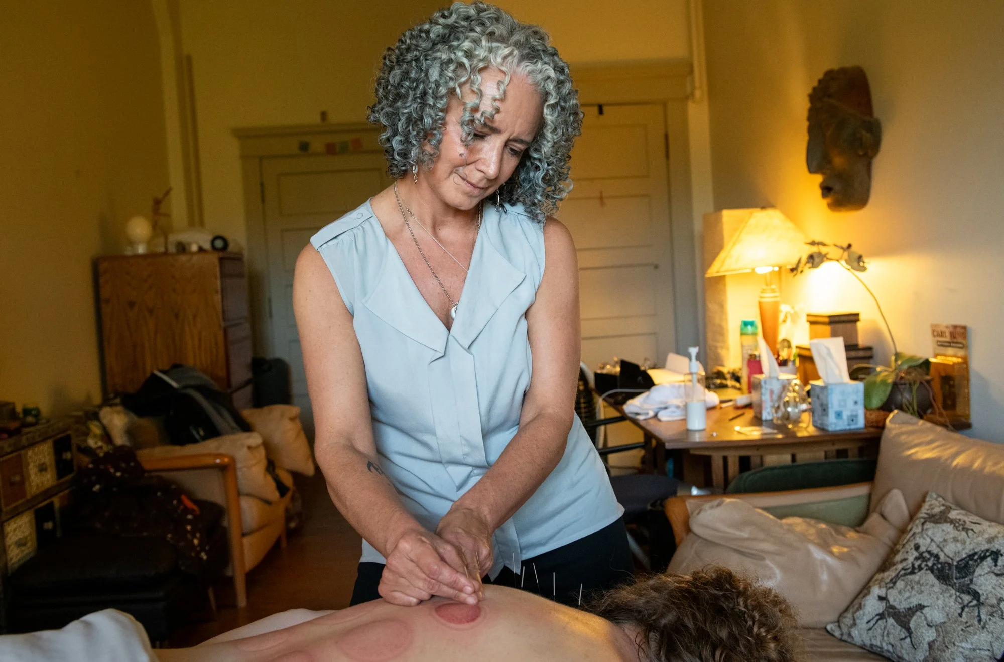 julie-acupuncture-17.jpg