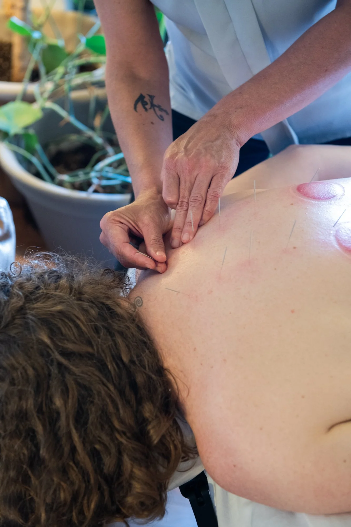julie-acupuncture-37.jpg