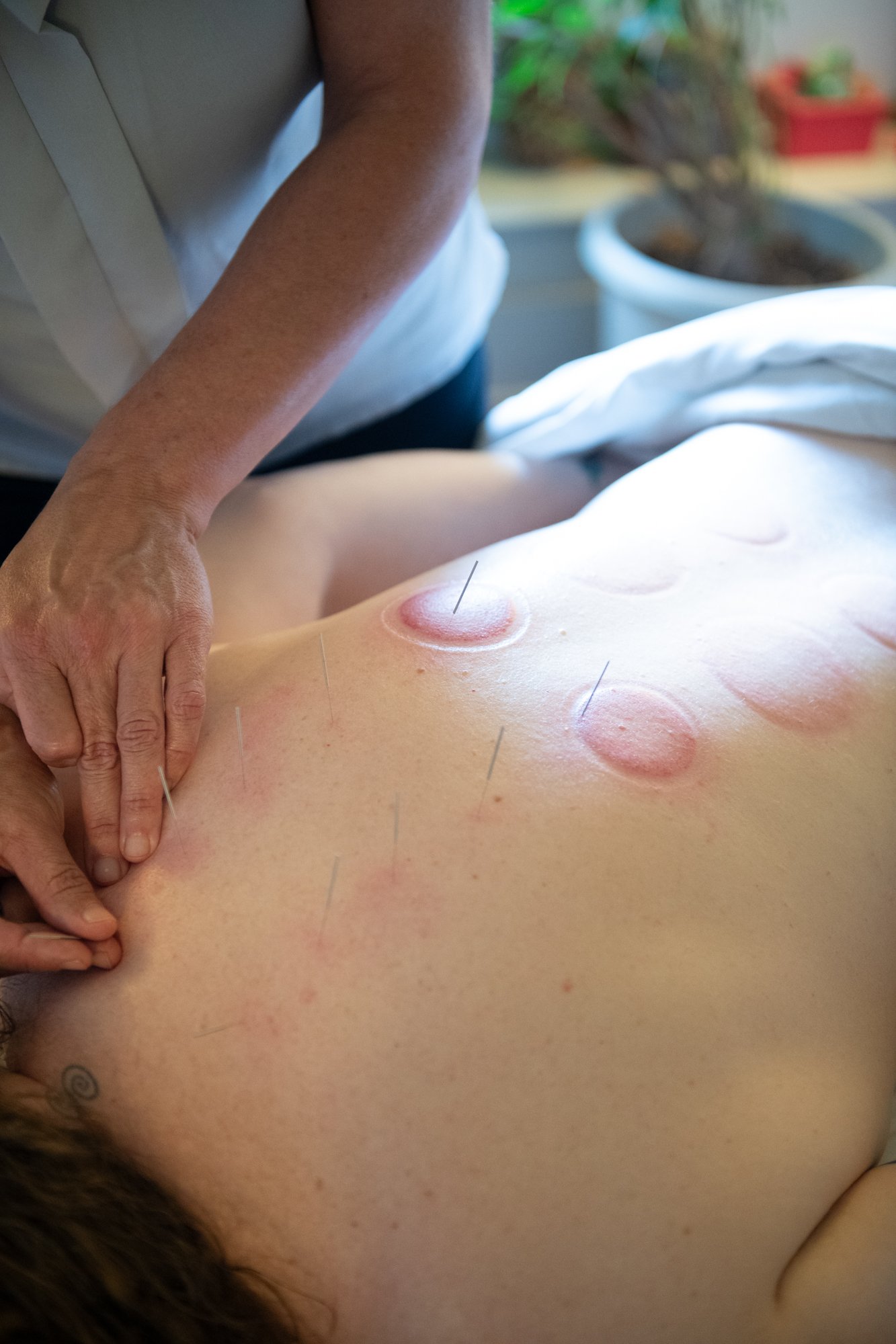 julie-acupuncture-38.jpg