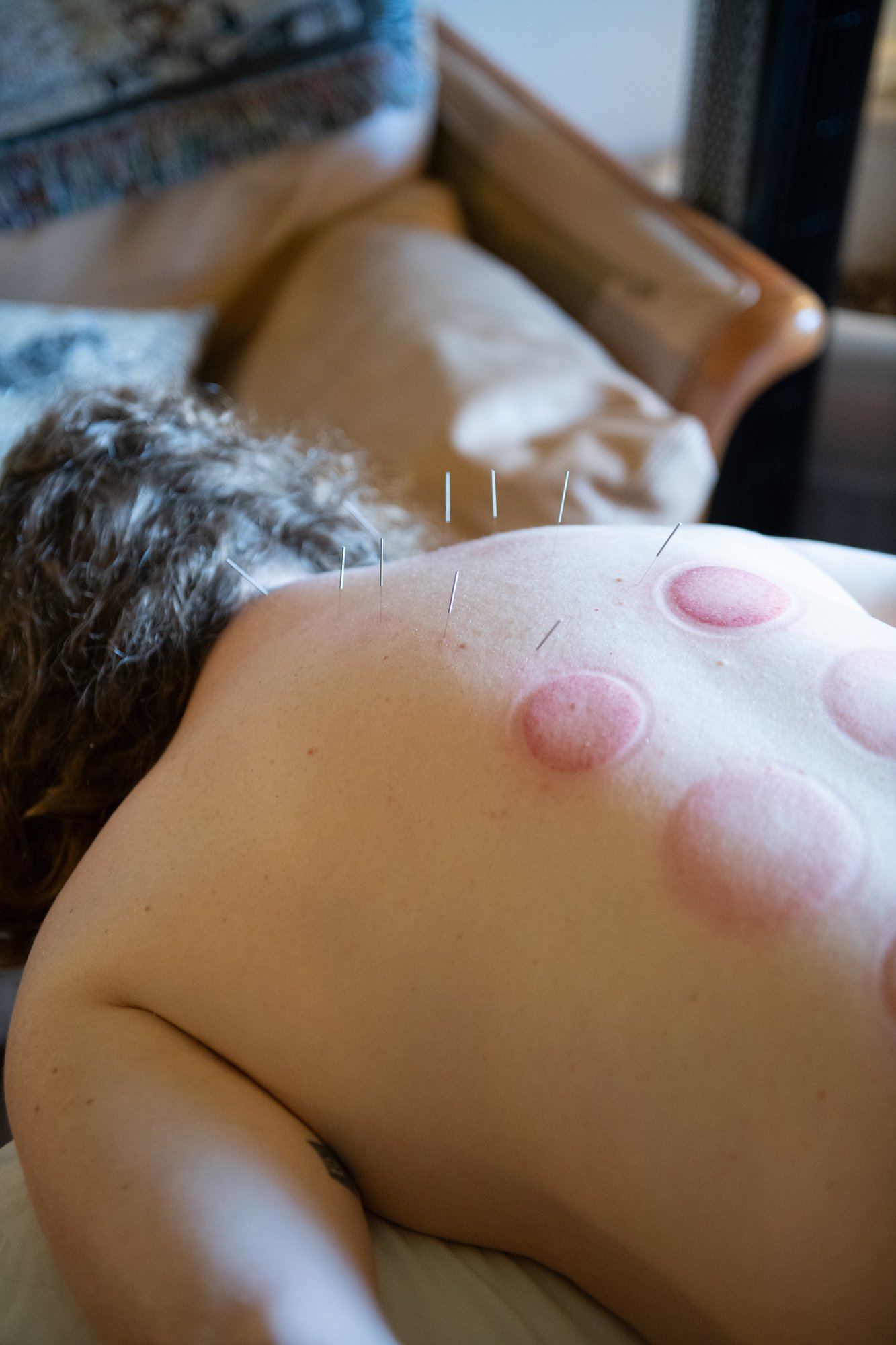 julie-acupuncture-40.jpg