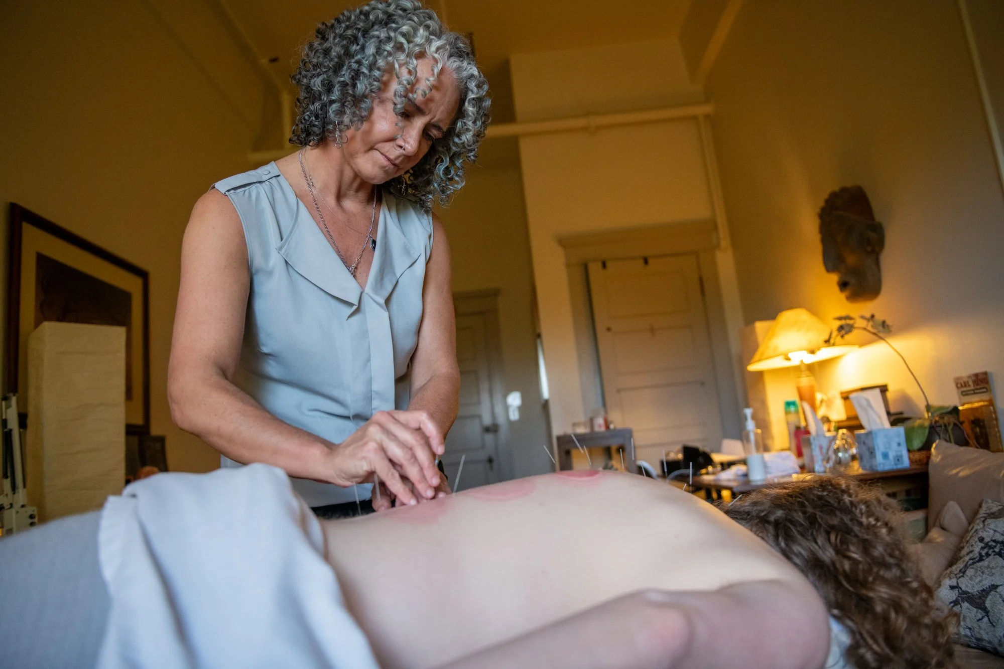 julie-acupuncture-50.jpg