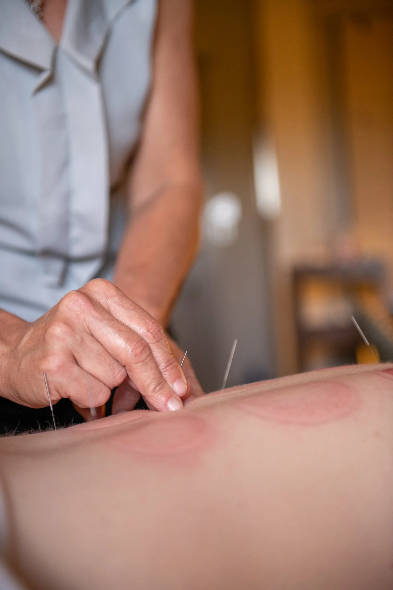 julie-acupuncture-51.jpg