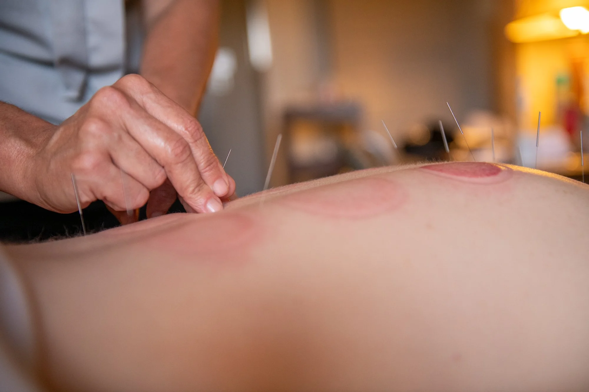 julie-acupuncture-53.jpg