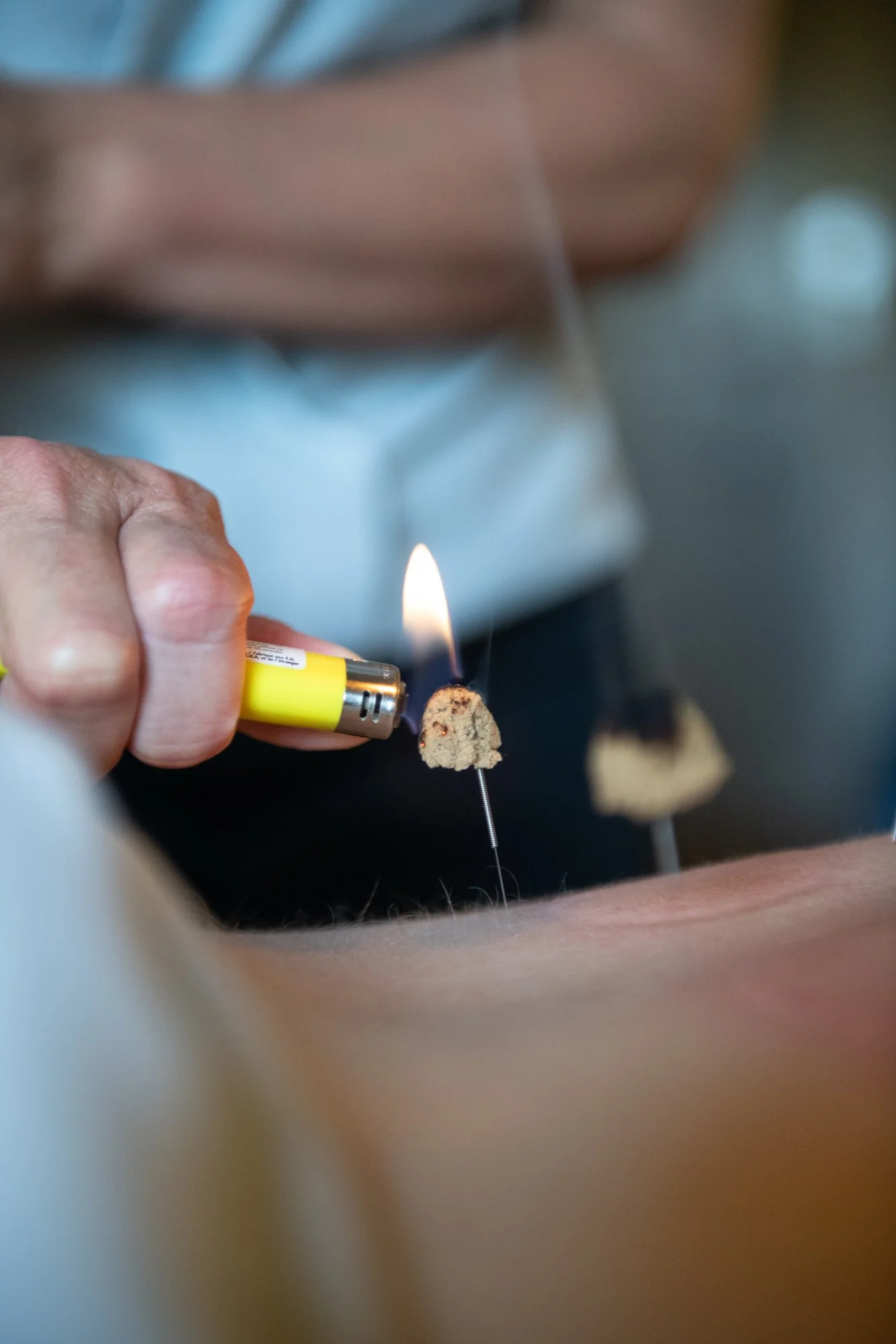 julie-acupuncture-60.jpg