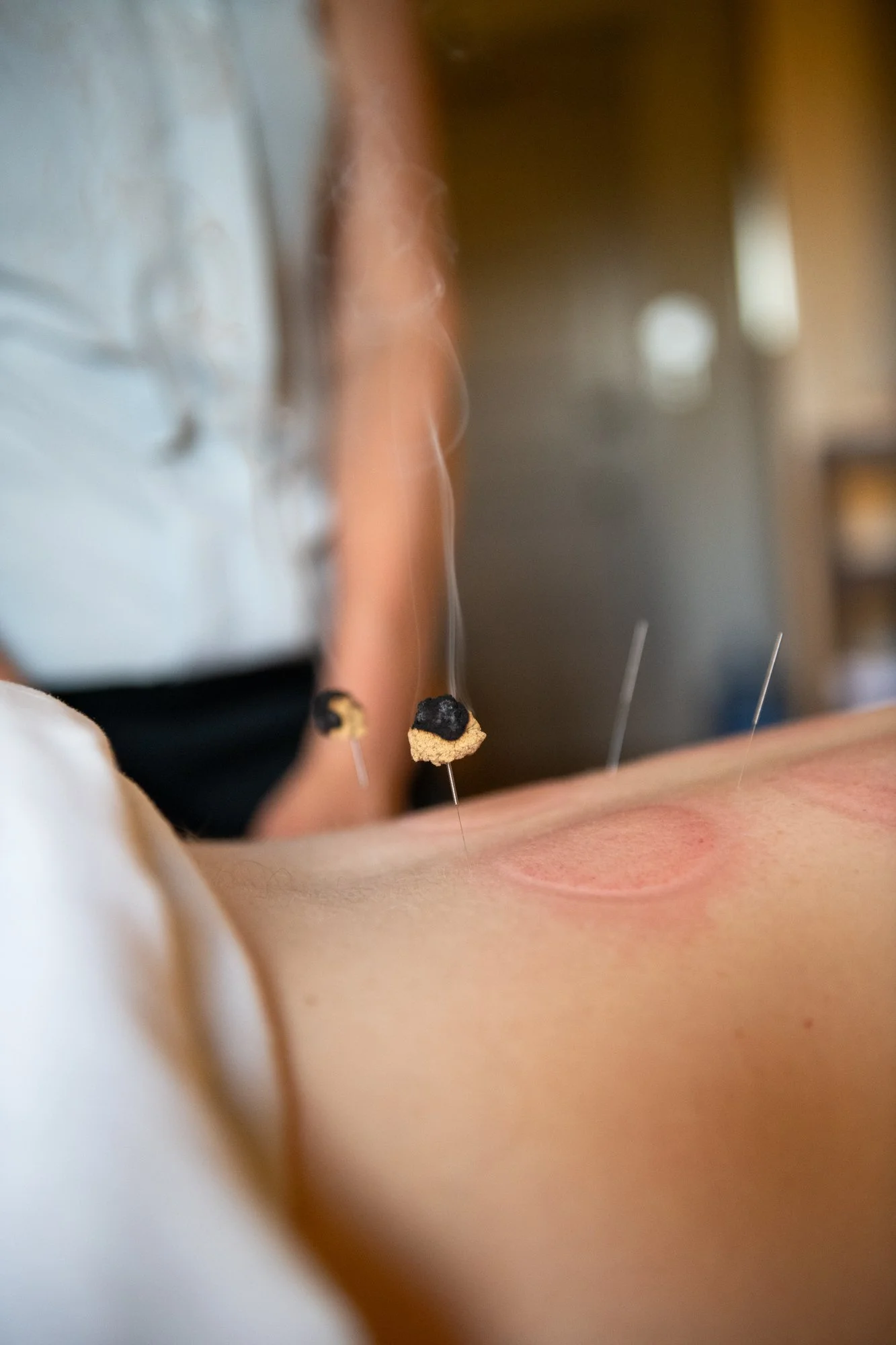 julie-acupuncture-62.jpg