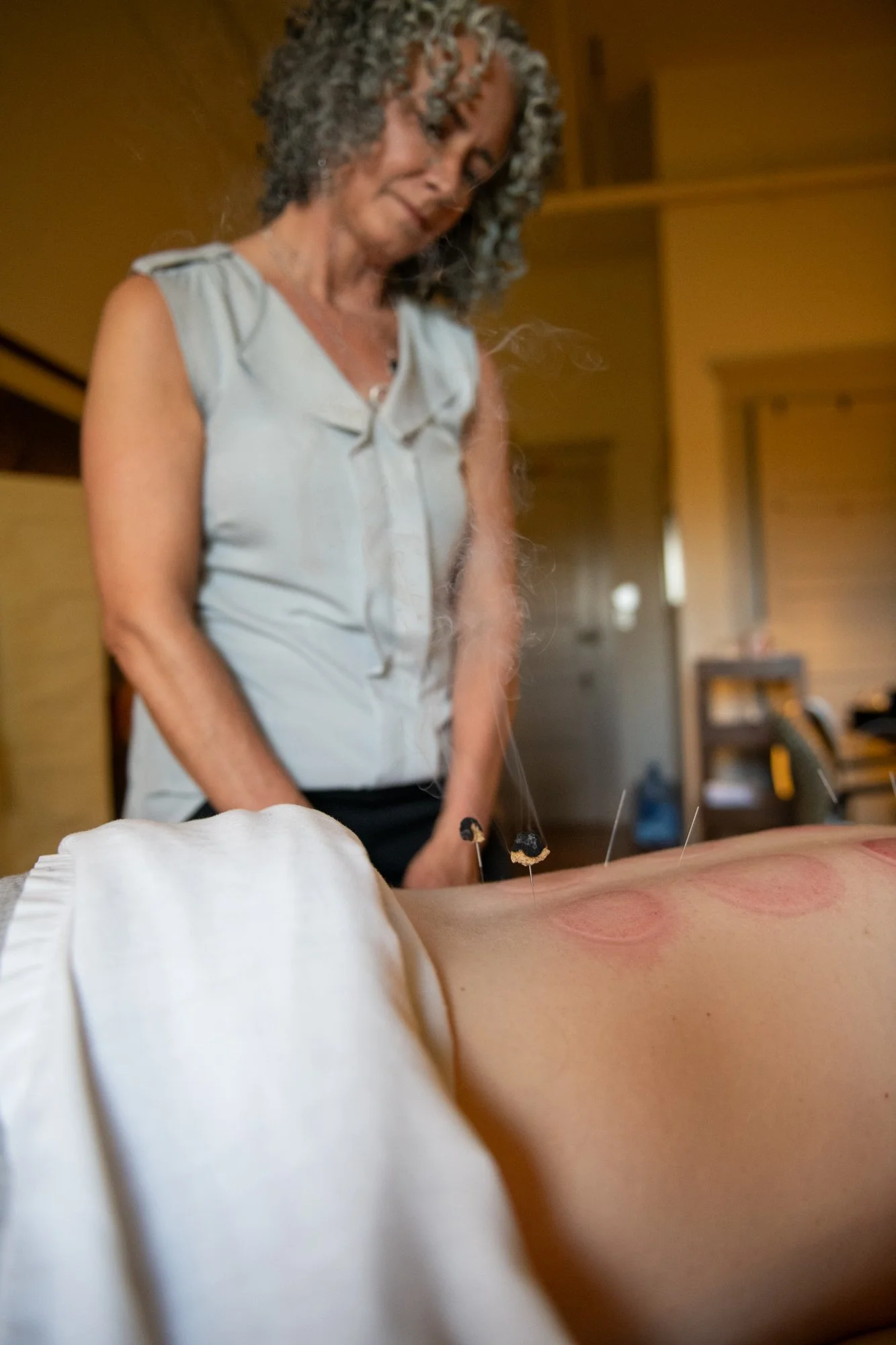 julie-acupuncture-63.jpg