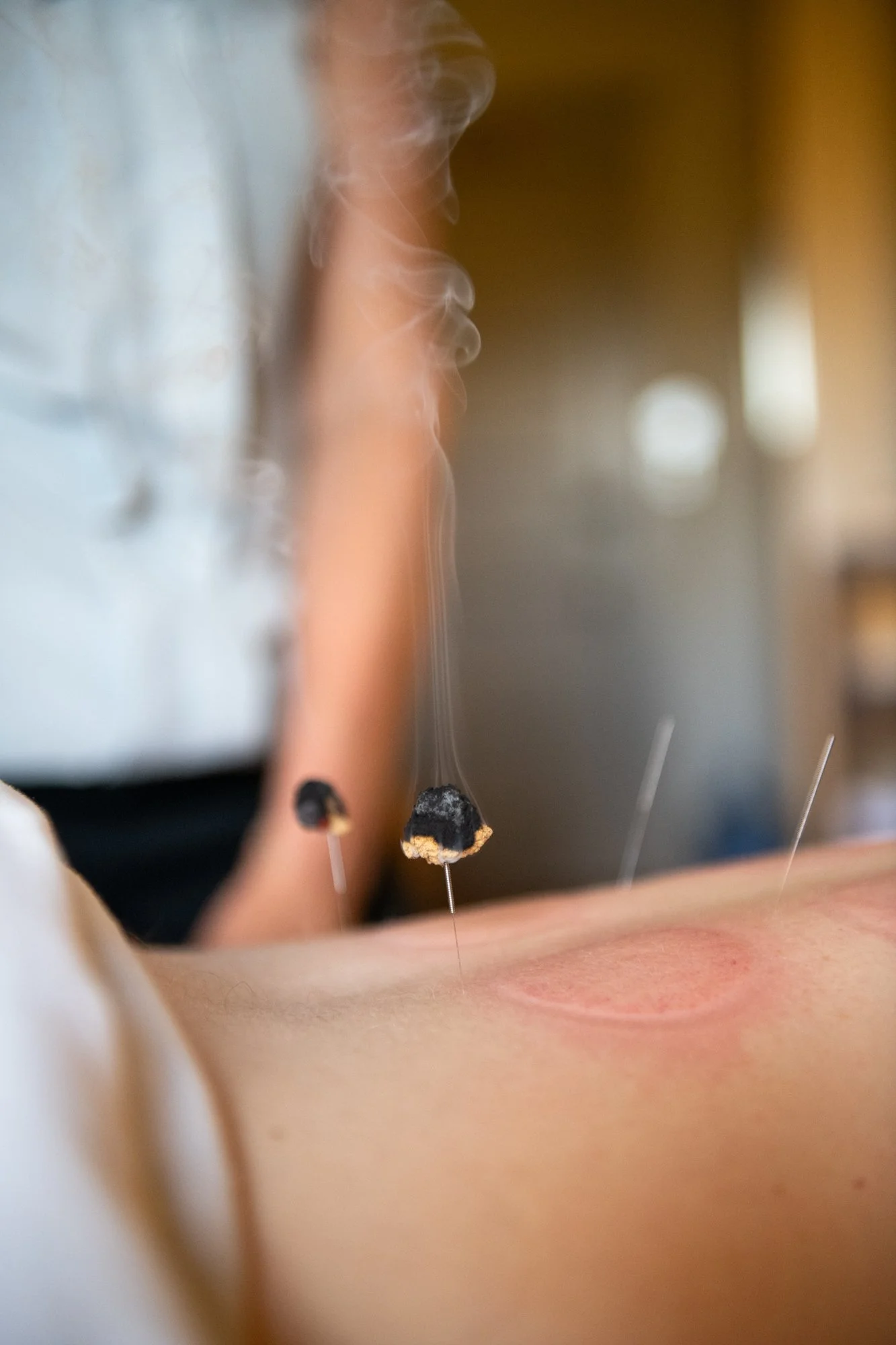 julie-acupuncture-64.jpg
