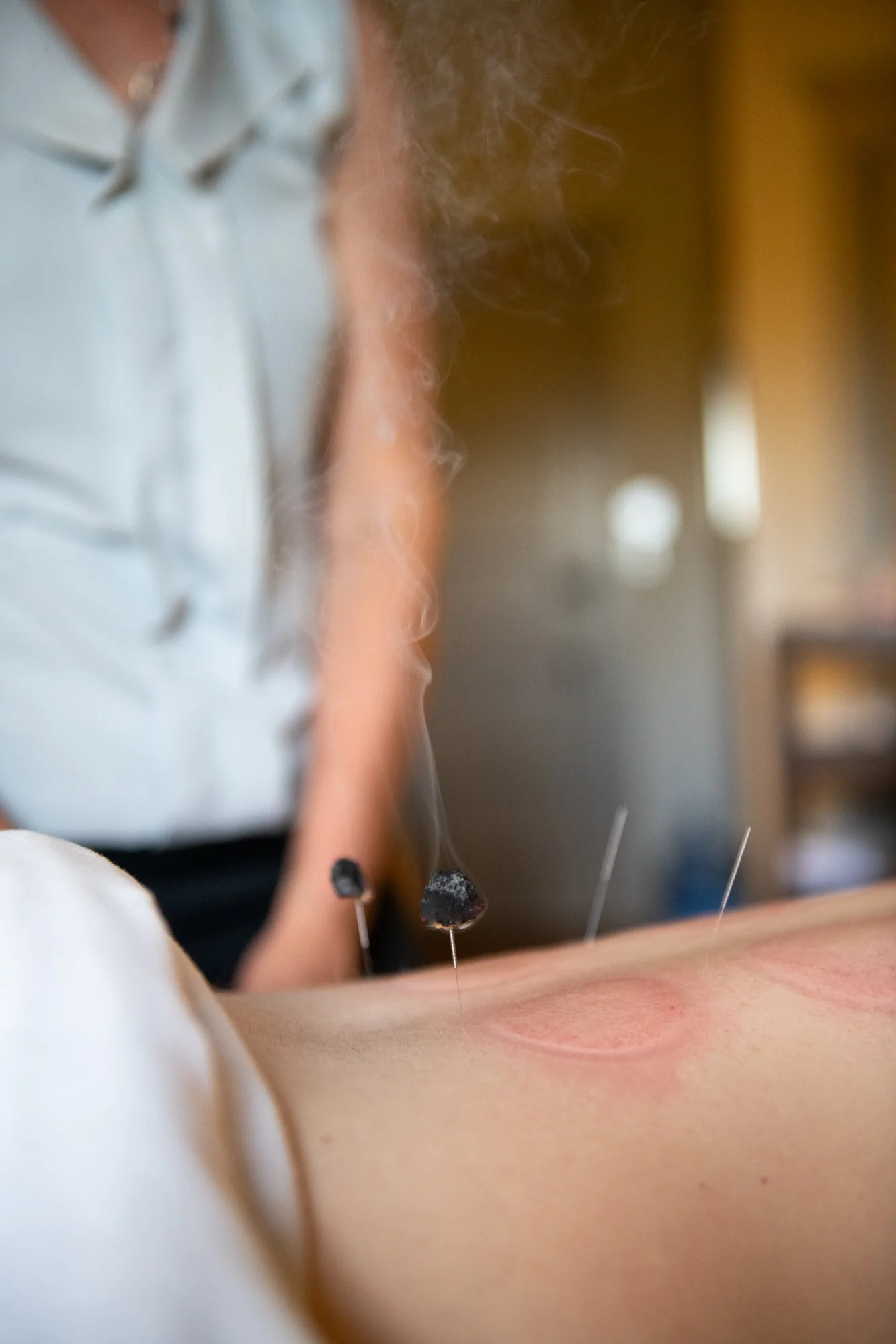 julie-acupuncture-66.jpg