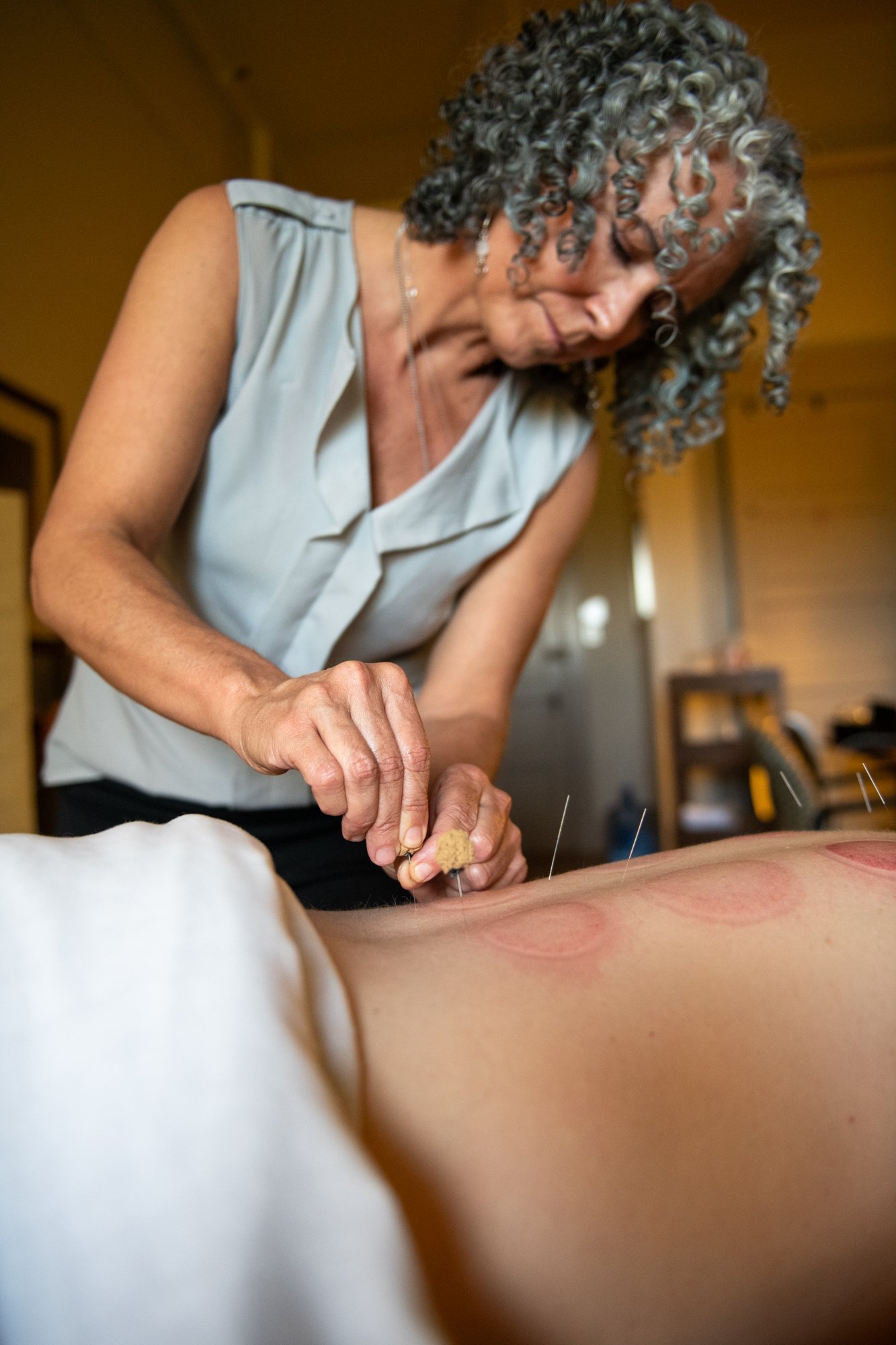 julie-acupuncture-69.jpg