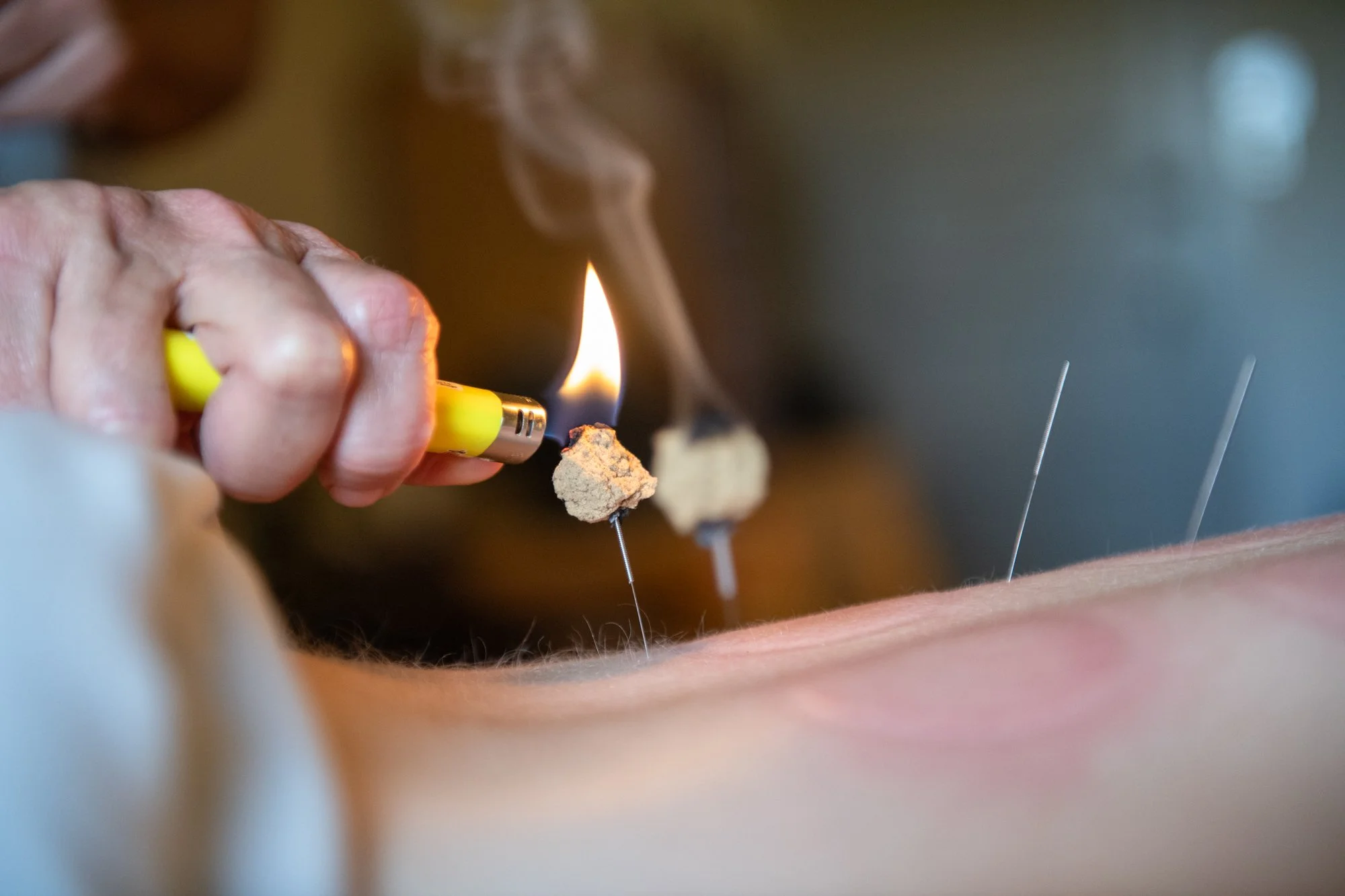 julie-acupuncture-72.jpg
