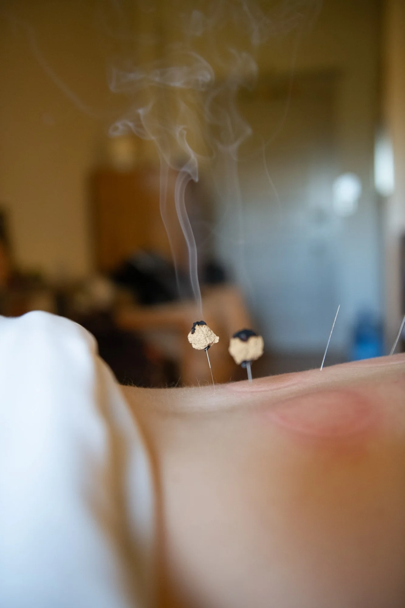 julie-acupuncture-73.jpg