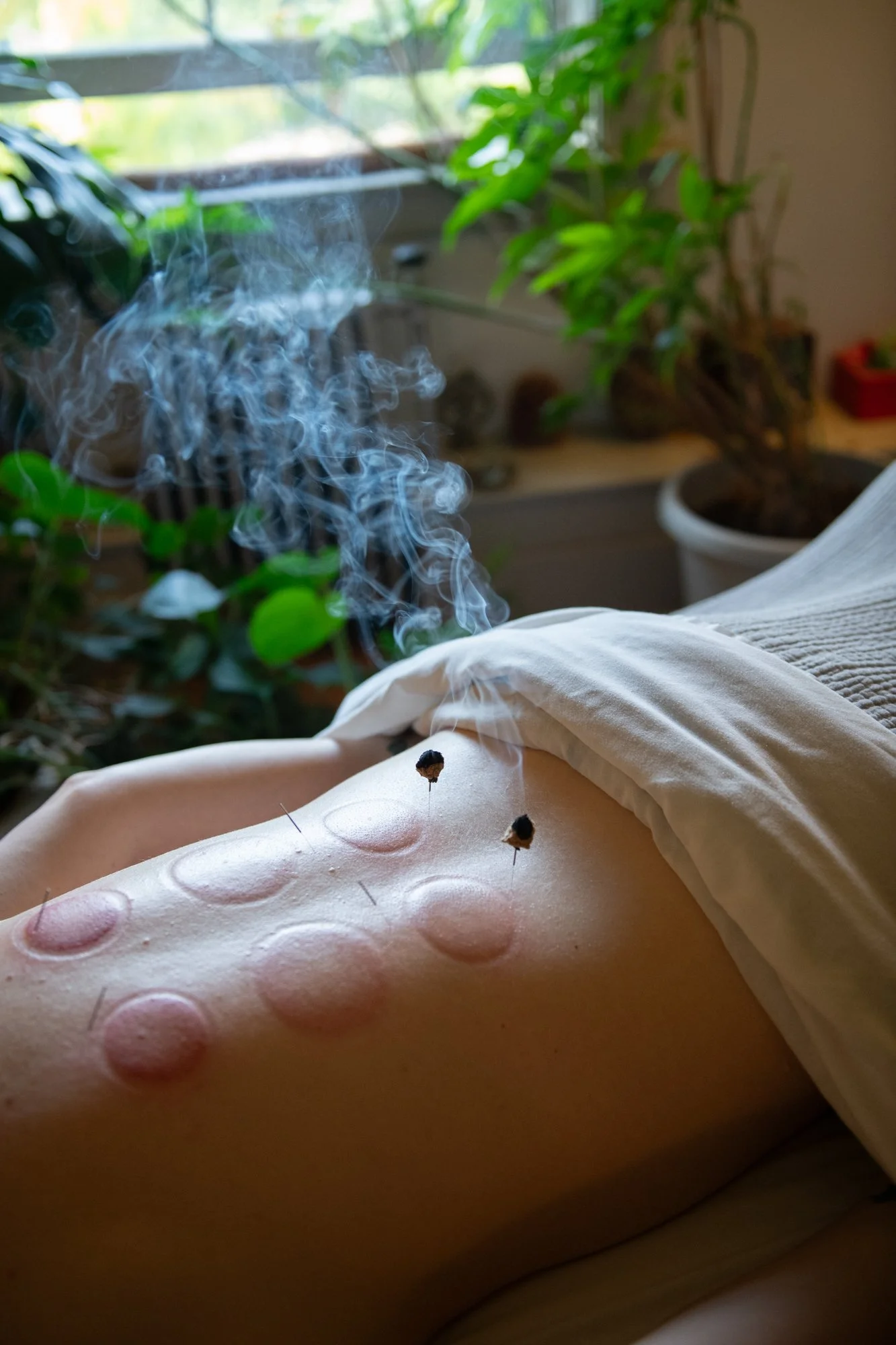 julie-acupuncture-74.jpg