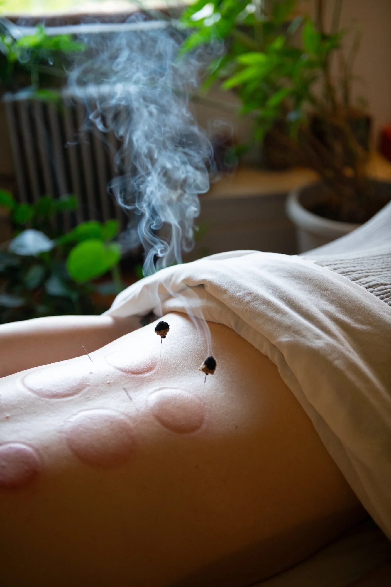 julie-acupuncture-75.jpg