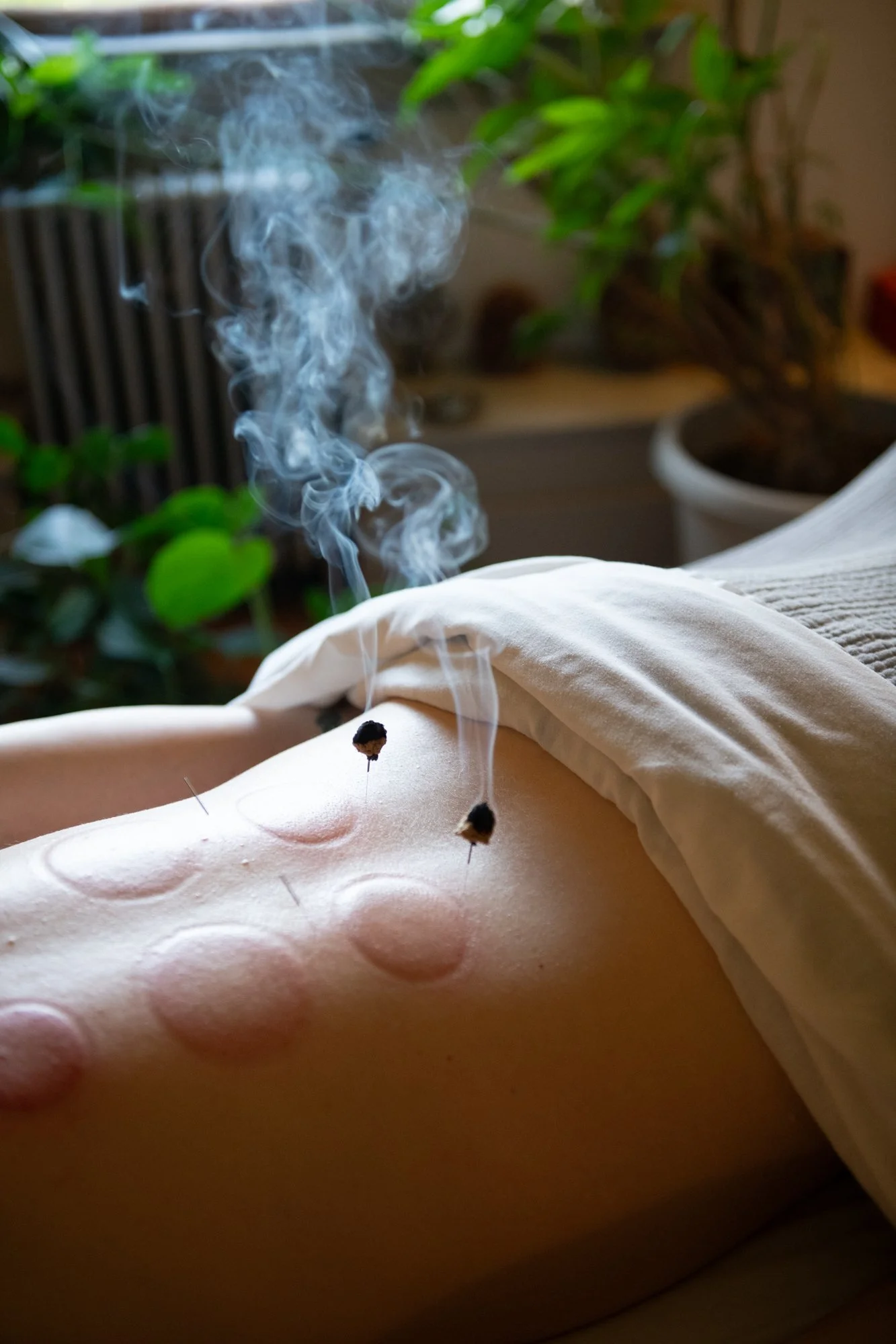 julie-acupuncture-76.jpg