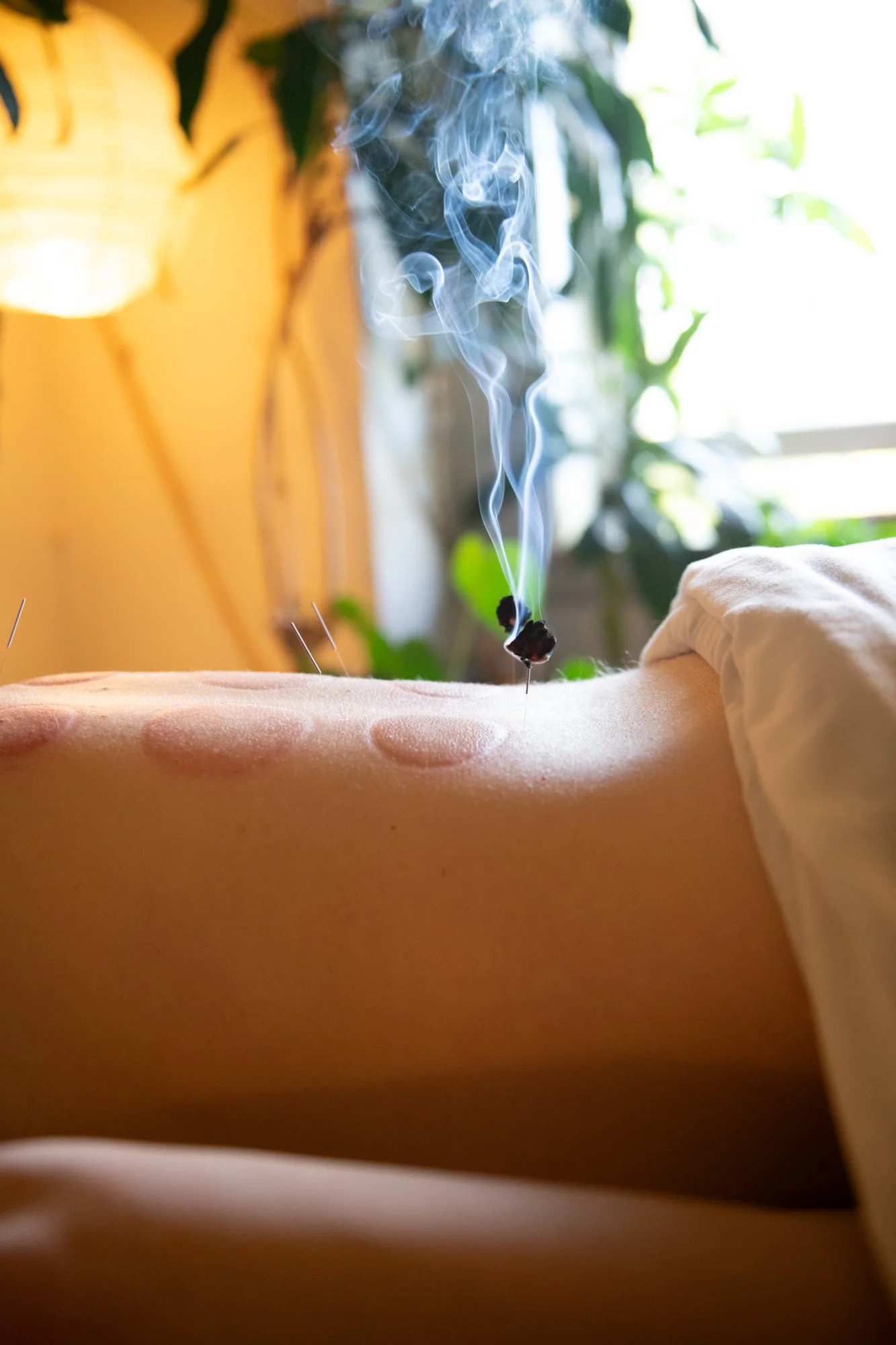 julie-acupuncture-80.jpg