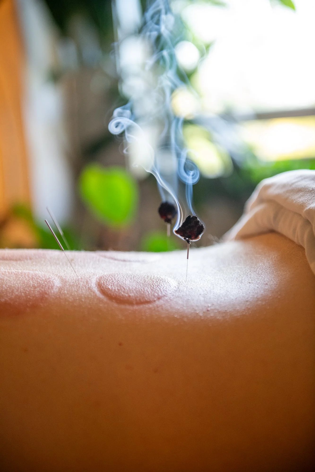 julie-acupuncture-81.jpg