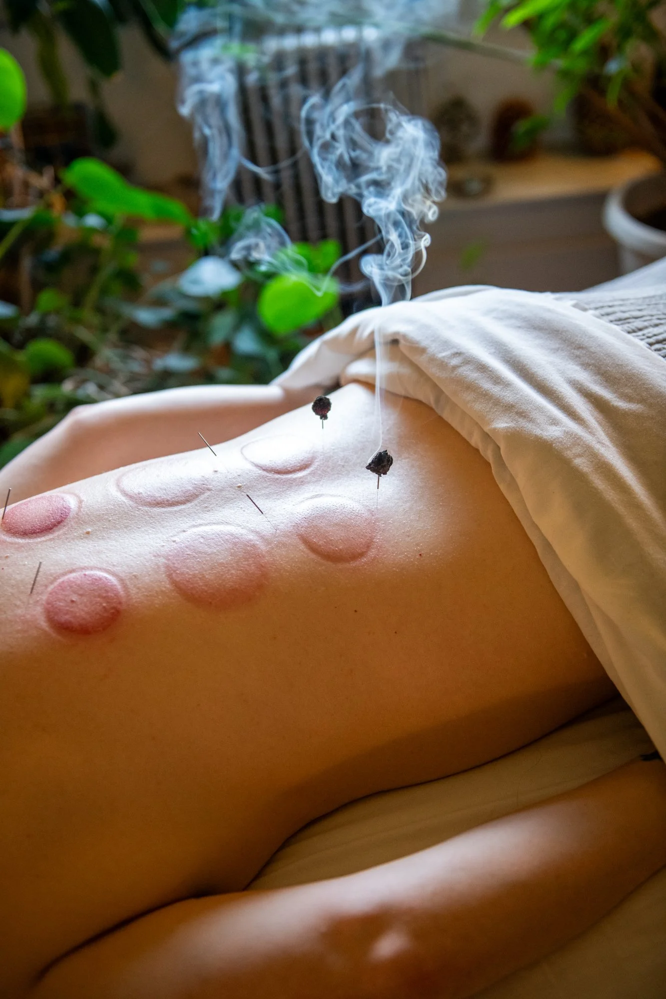 julie-acupuncture-82.jpg