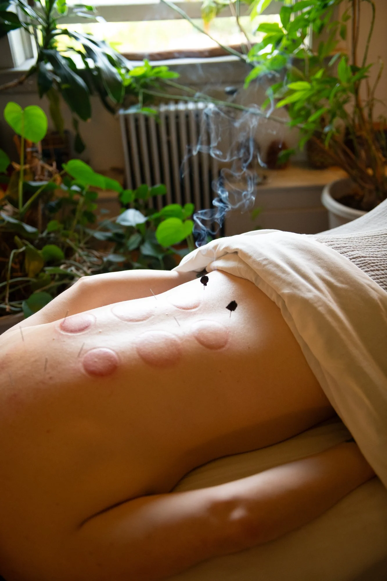 julie-acupuncture-83.jpg