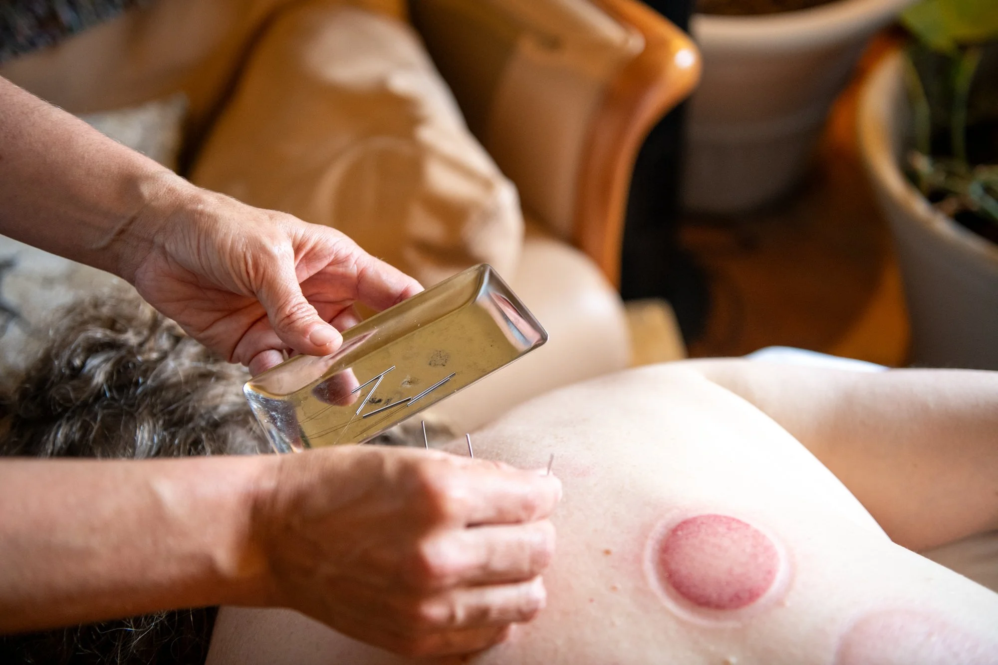 julie-acupuncture-85.jpg