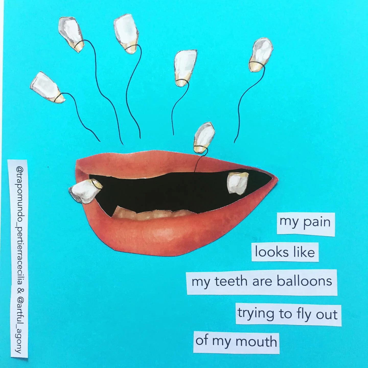 TOOTH BALLOONS ‘My pain looks like my teeth are balloons trying to fly out of my mouth.’ @trapomundo_pertierracecilia