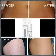 B Glucan Anti cellulite body balm