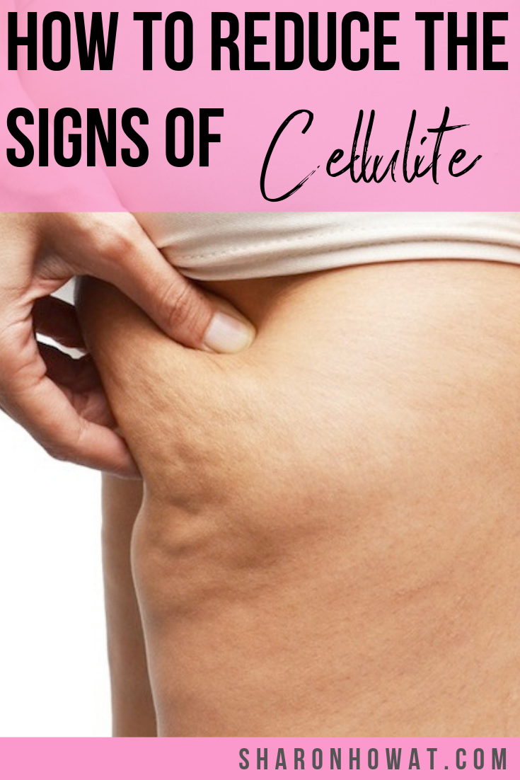 How to get rid of cellulite and reduce cellulite appearance. Click through for some answers and tips to common questions about how to reduce cellulite.  #anticellulite #cellulitereduction #cellulite #howtogetridofcellulite