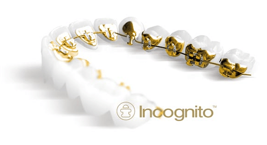 Incognito-Braces.png