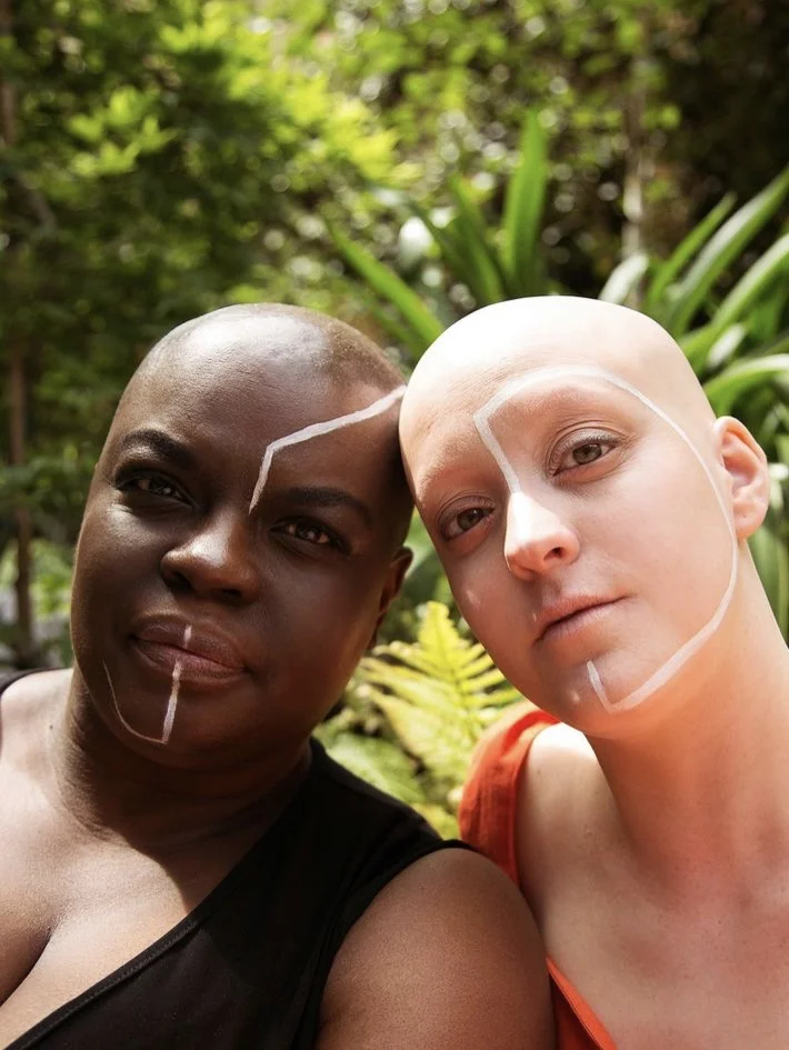 These Images Of Beautiful Bald Women Prove That Our Hair Does Not Define Us