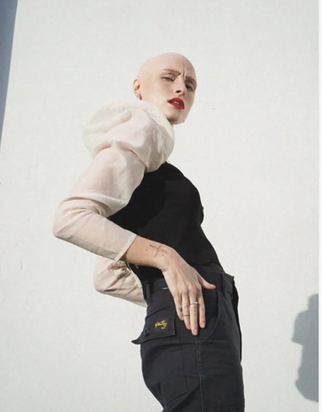 My most challenging &amp; difficult times through my Alopecia journey 