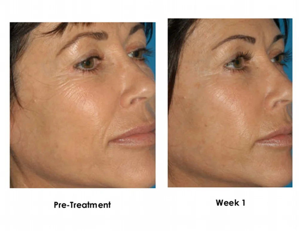 ba-eye-serum-31_1000.jpg