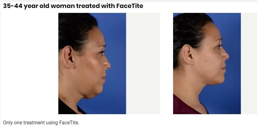 facetite july promo.jpg