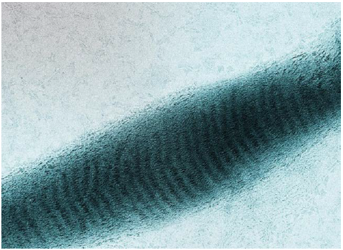 Magnification: 21,000X