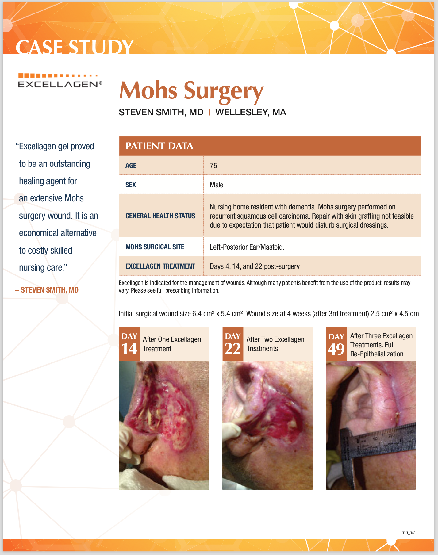 thumb-mohs-smith2.png