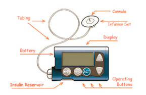 Figure 14 Medtronic Insulin Pump