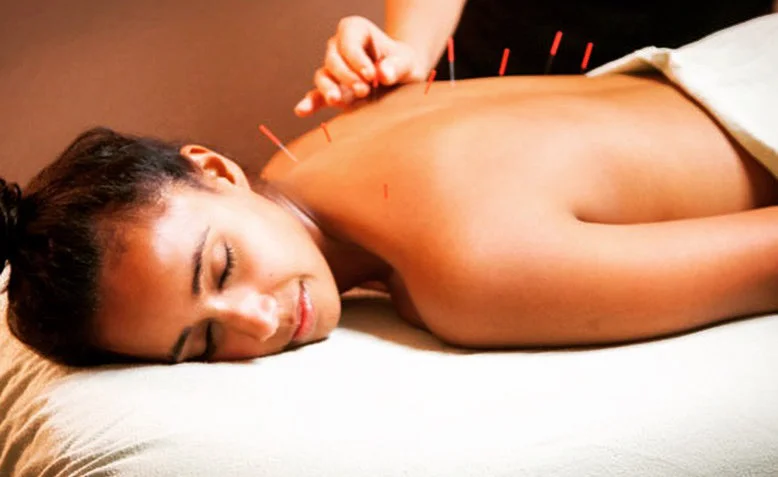 All About Acupuncture: Interview with Jessica Escobedo, L.Ac.