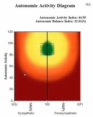 HRV AutonomicActivityDiagram.jpg