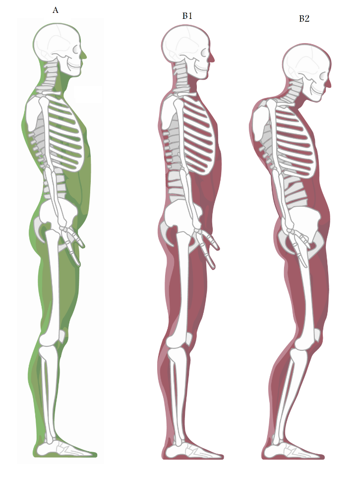 posture pics.png