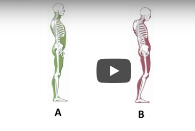 Posture A or Posture B - Which one are you? 
