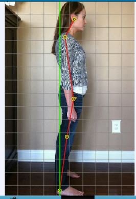 Attend a Free Spinal and Posture Screening on July 23rd