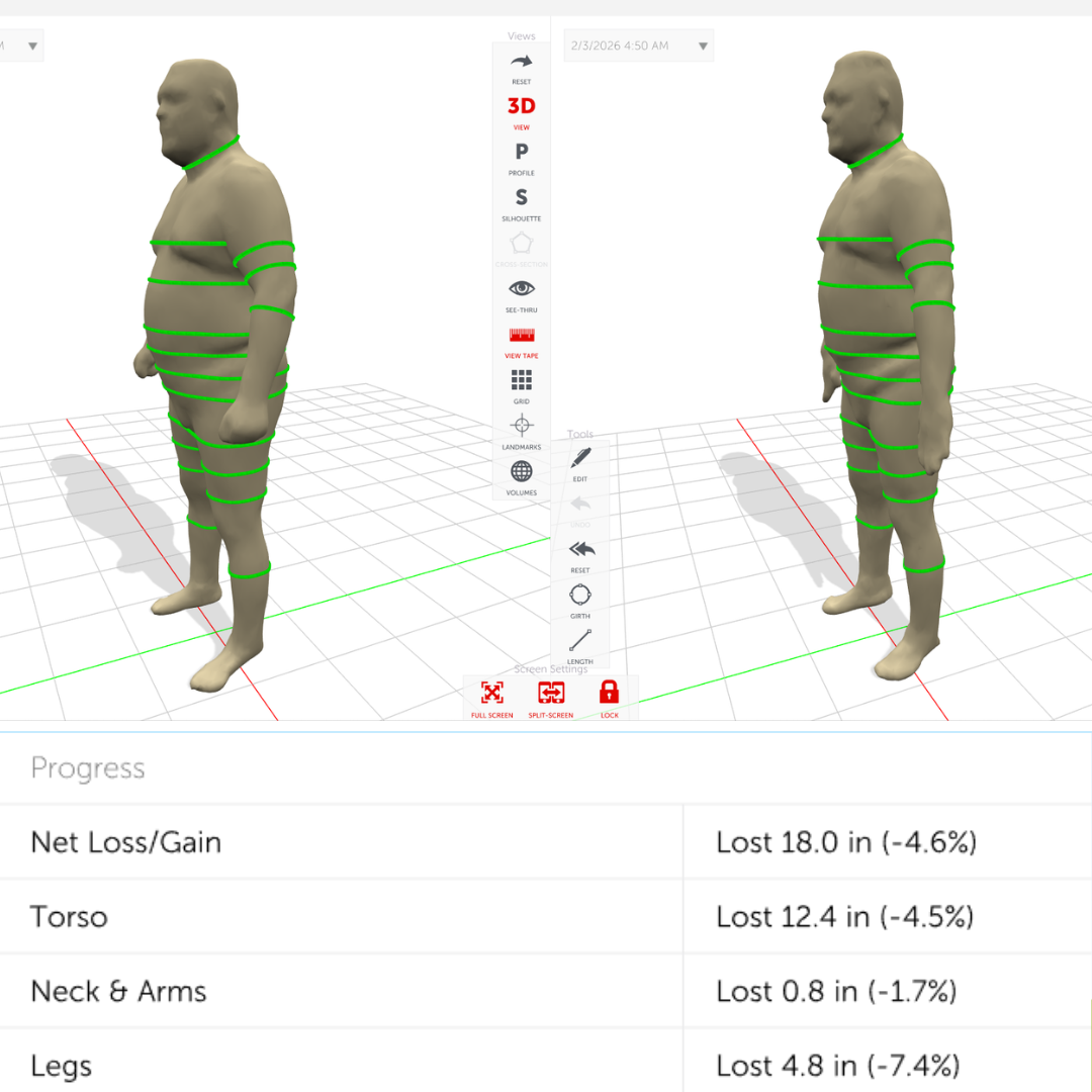 Side by Side - MIKE.png