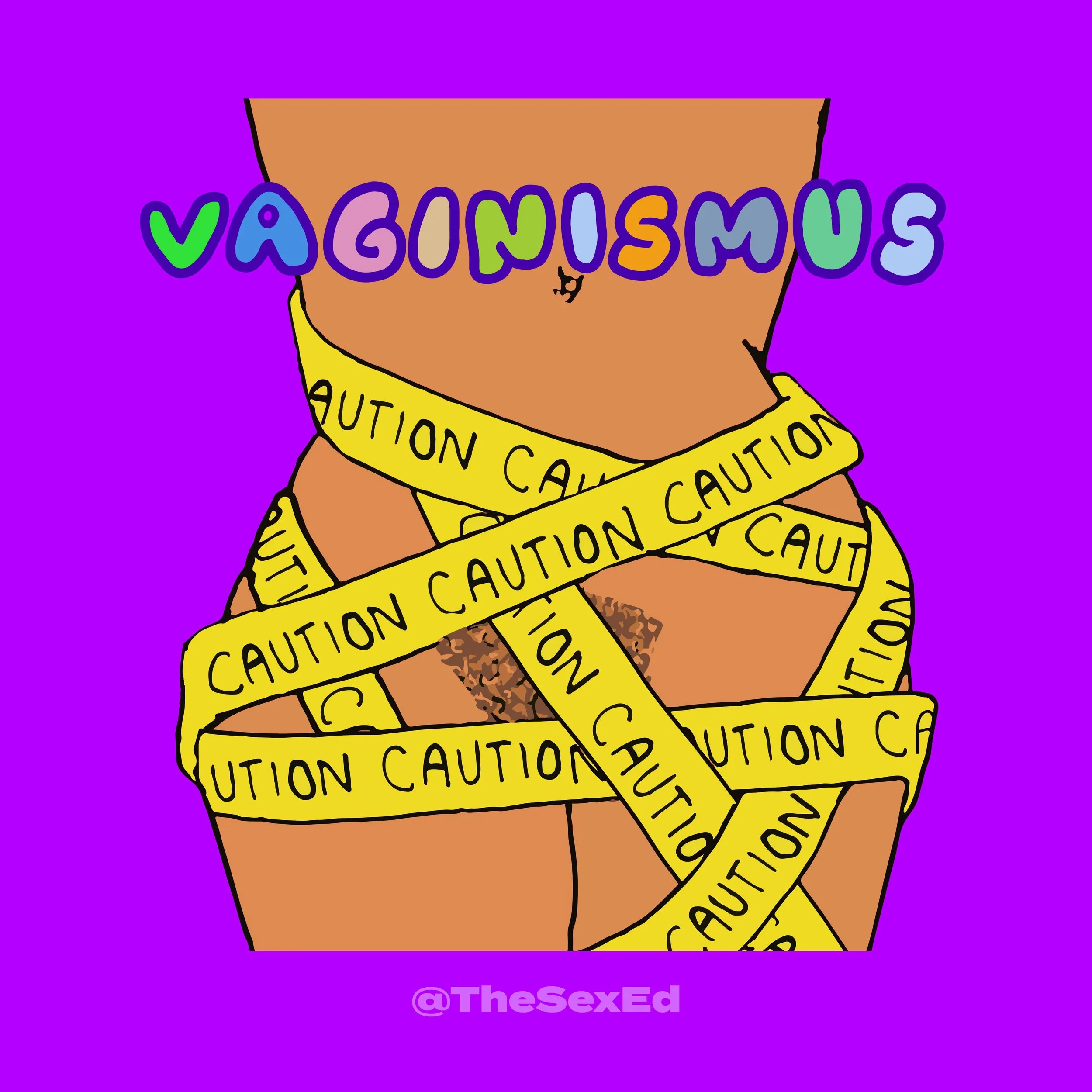 Vaginismus Mini Guide