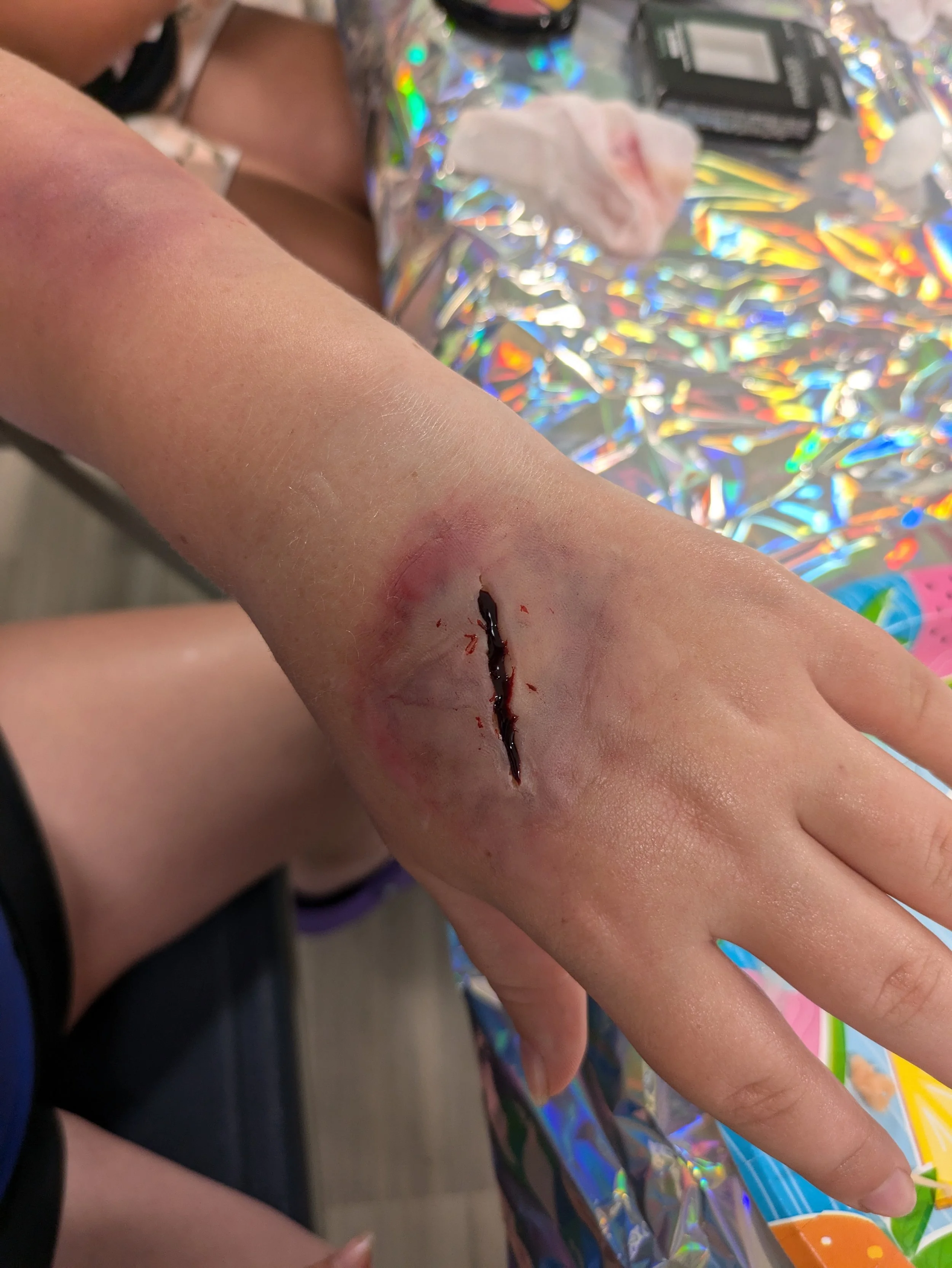 Cuts &amp; Bruises @ Haverhill Library--FREE