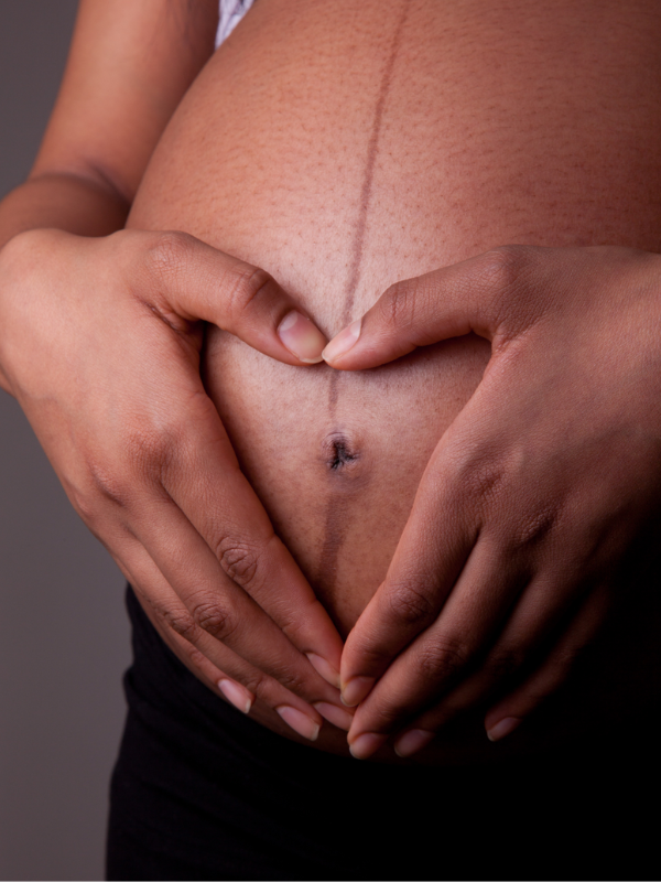 Split Belly Button How To Prevent Diastasis Recti (Ab Separation_ — The Kegel