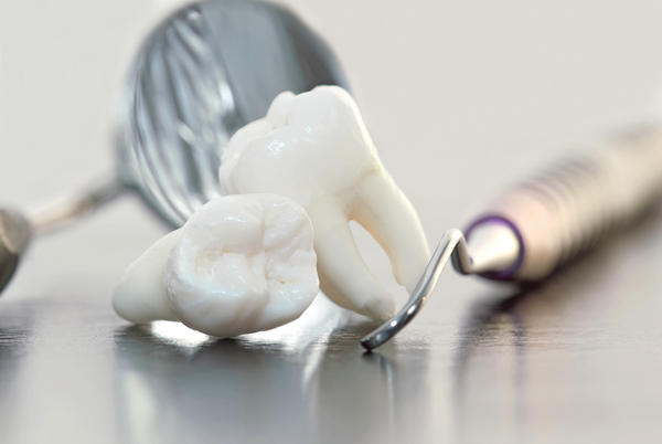 Wisdom_teeth.jpeg